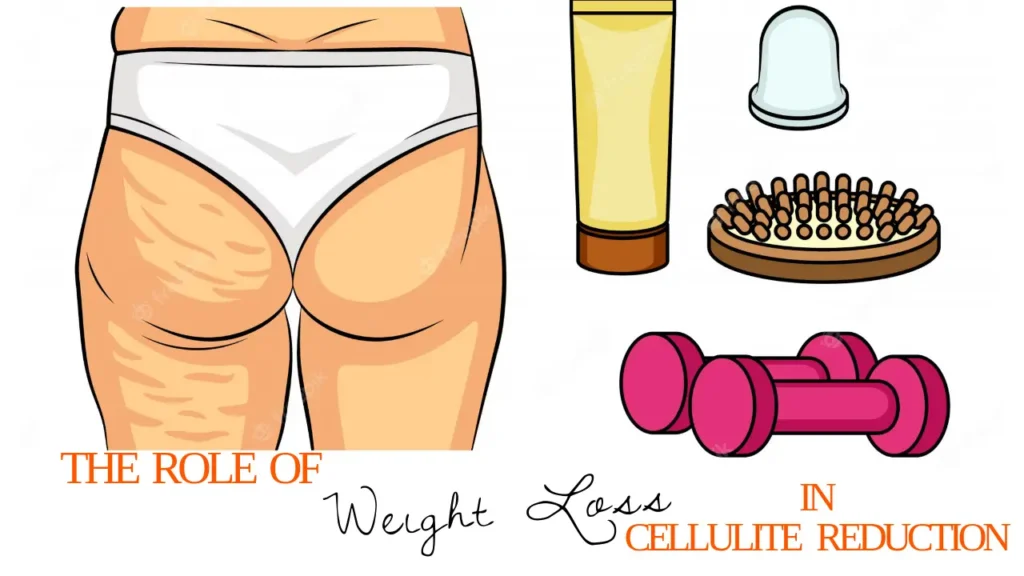 The Role of Weight Loss in Cellulite Reduction