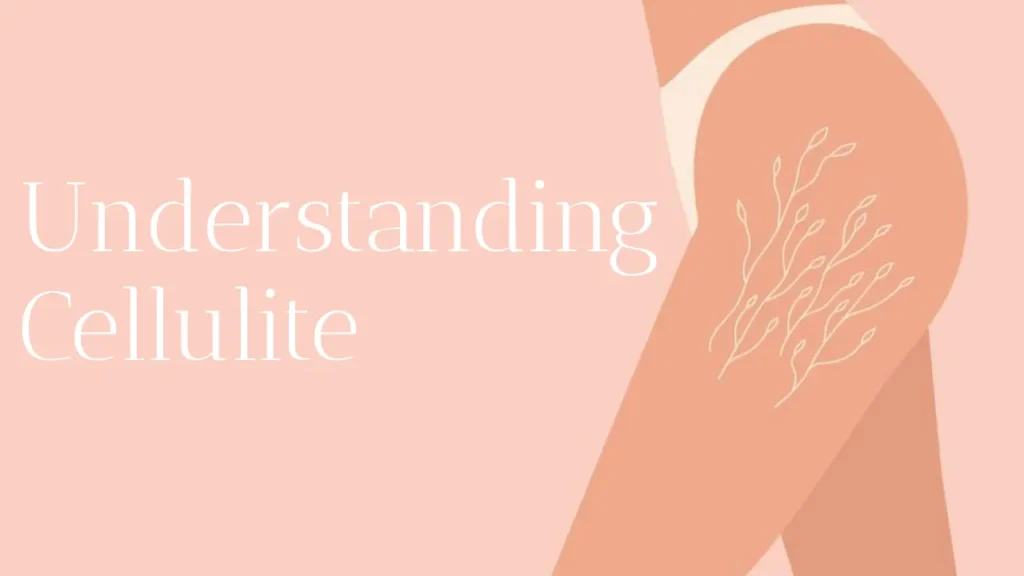 Understanding Cellulite