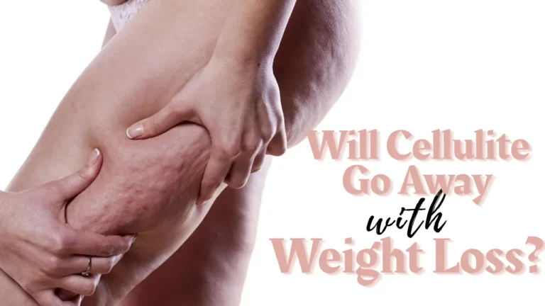 Will Cellulite Go Away with Weight Loss?
