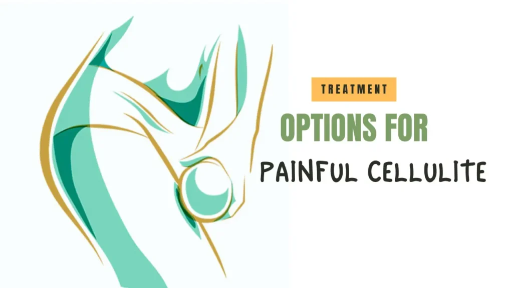 Treatment Options for Painful Cellulite