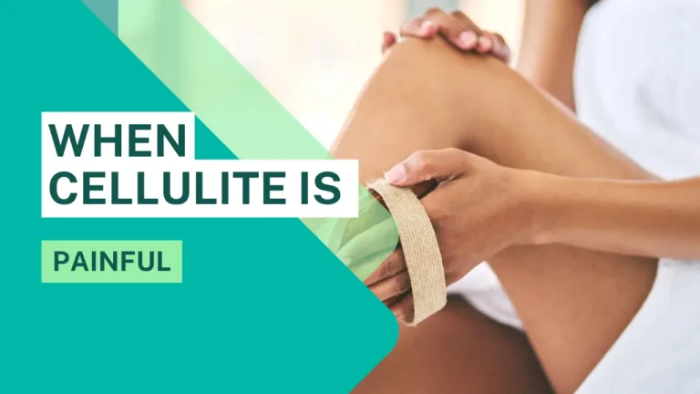 When cellulite is painful