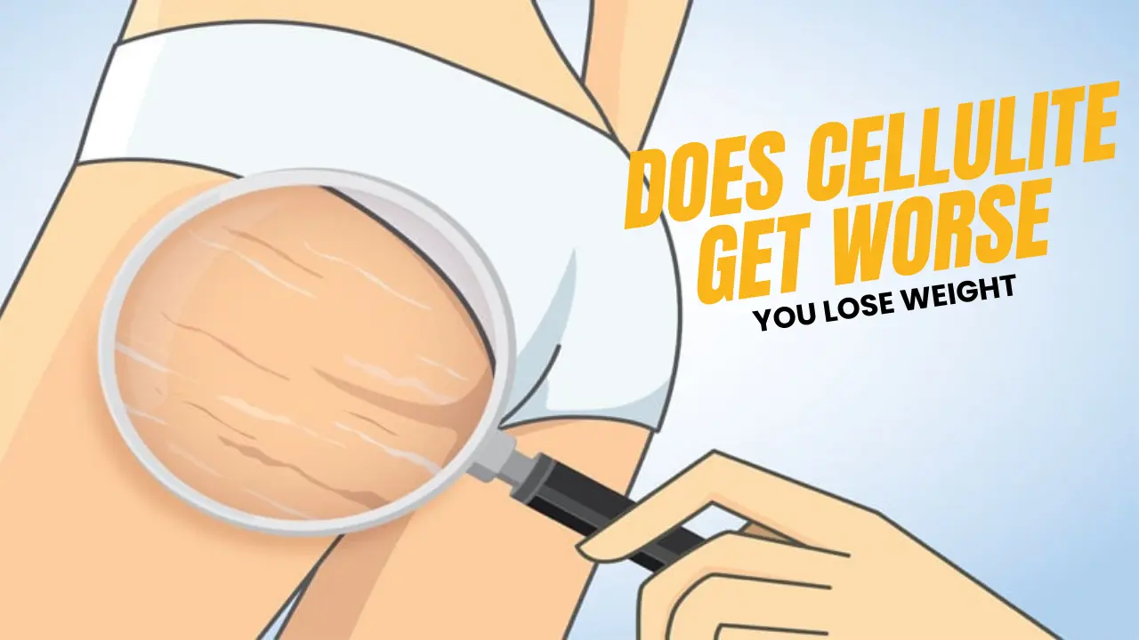 Does cellulite get worse when you lose weight