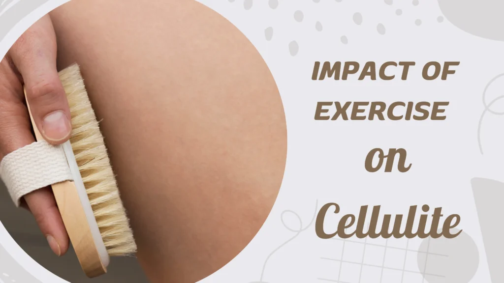 Impact of Exercise on Cellulite