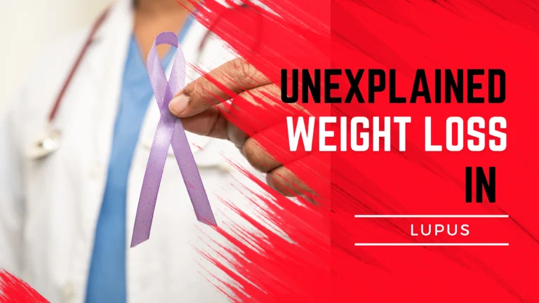Unexplained Weight Loss in Lupus