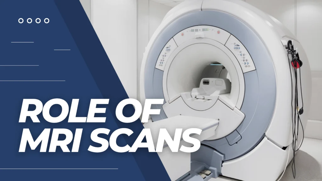 The Role of MRI Scans in Multiple Sclerosis Diagnosis